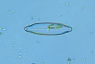 fig.09 �q�V�K�^�P�C�\�E��