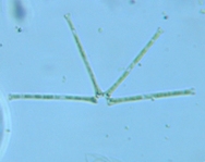 fig.10 �z�V�K�^�P�C�\�E��