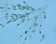 fig.11 �T���c�i�M��