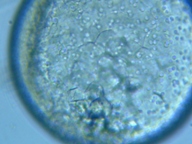 fig.05 Microcystis�Q��