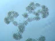 fig.03 �~�N���L�B�X�e�B�X