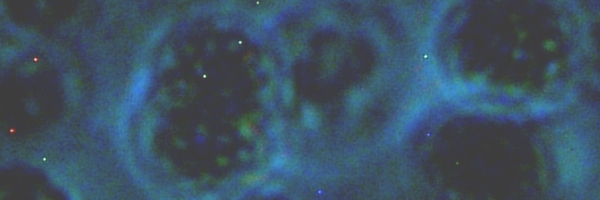 fig.05 �~�N���L�B�X�e�B�X