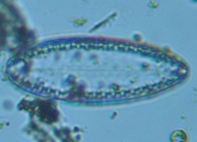 fig.10 �R�o���P�C�\�E���i�]���j