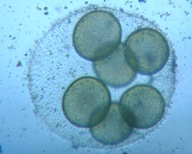 fig.04 �I�I�q�Q�}������