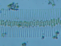 fig.05 �I�r�P�C�\�E��