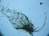 fig.02 �P���~�W���R��