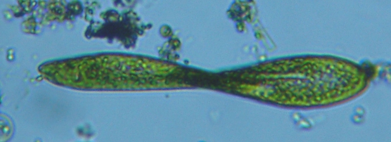 fig.01 ���v���̃~�h�����V
Euglena ehrenbergii KLEBS,1883