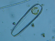 fig.04 �R�o���P�C�\�E���i�]���j