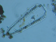 fig.05 �R�o���P�C�\�E���i�]���j