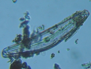 fig.06 �N�`�r���P�C�\�E��