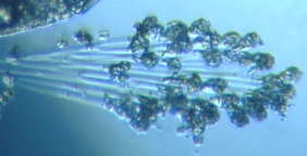 fig.11 �G�s�X�e�B���X��