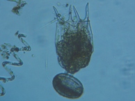 fig.11 �c�{�����V