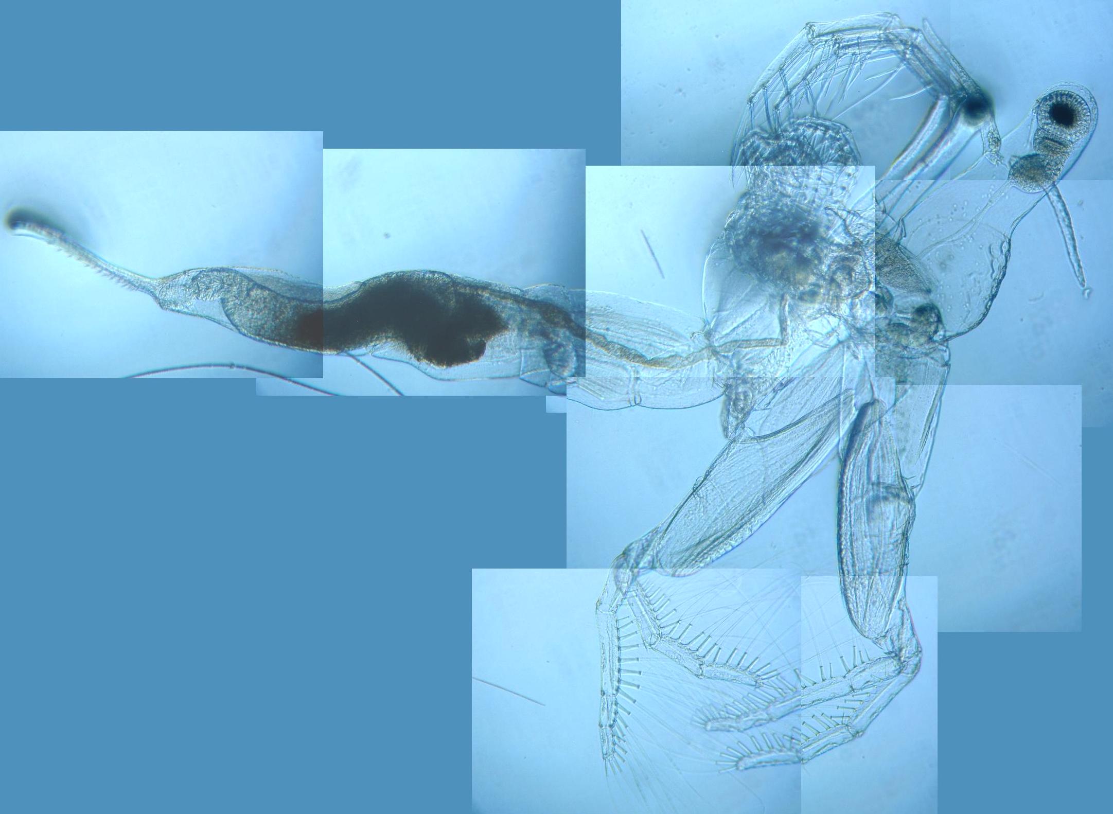fig.01 �m���i�I�X�jLeptodora kindtii
�S���R�����̌������ʐ^��
���Ȃ����A�X���Ă�������