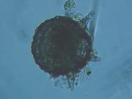 fig.11 �A���P�����