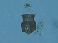 fig.14 �X�i�J�����V��