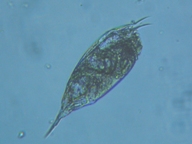 fig.11 �l�Y�~�����V��