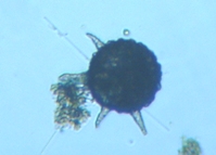 fig.15 �A���P�����