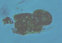 fig.05 ハネウデワムシ