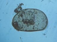 fig.05 �J�C�~�W���R���i�k�j