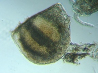 fig.08 �~�W���R�ڂ̑ϋv��