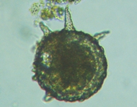 fig.18 �f�B�t���M�A��