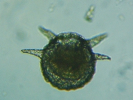 fig.15 �f�B�t���M�A��