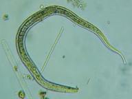 fig.11 �Z���`���E�̂P��