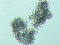 fig.14 �~�N���L�X�e�B�X