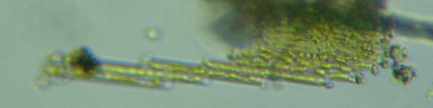 fig.04 �N�T���P�C�\�E