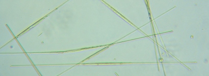 fig.11 �V�l�h����