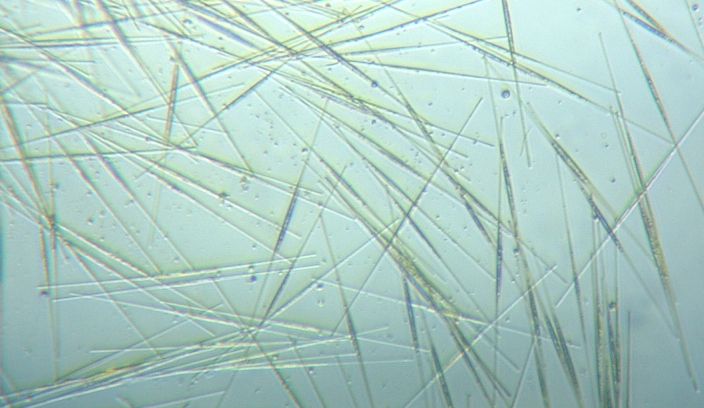 fig.01 �T�R�΂̃V�l�h����