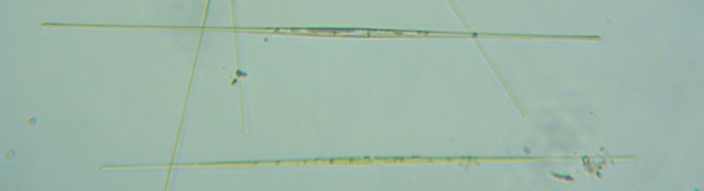 fig.02 �T�R�΂̃V�l�h����