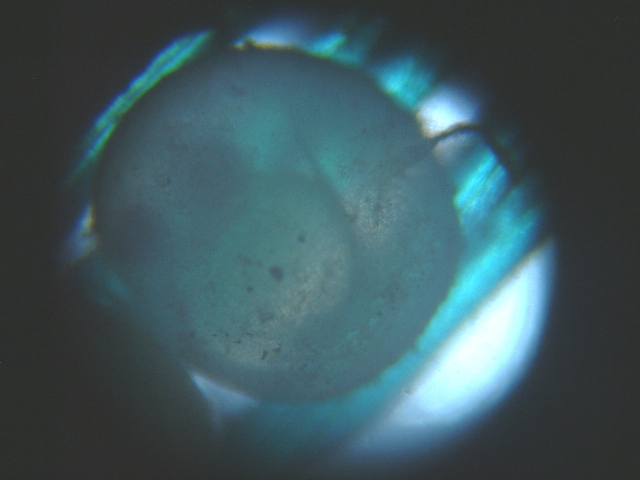 fig.01 �z�������R�̔��ᗑ