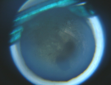 fig.05 ���ᗑ�i�������ʐ^�j