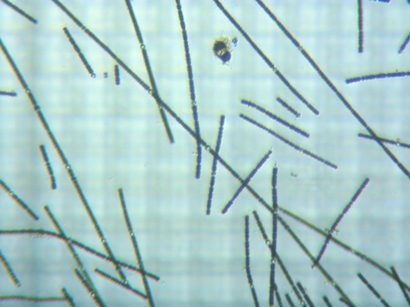 fig.02 �\�w�̃A�i�x�i