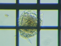 fig.11 �c�L�K�^�����V��