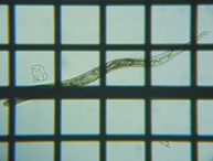 fig.15 �Z���`���E�̂P��