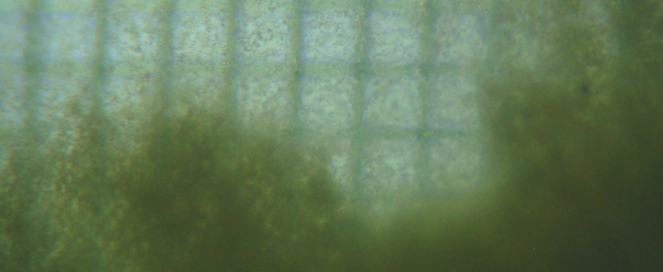 fig.02 ����ɖ��m�ȑ@�ێ��͌����Ȃ�