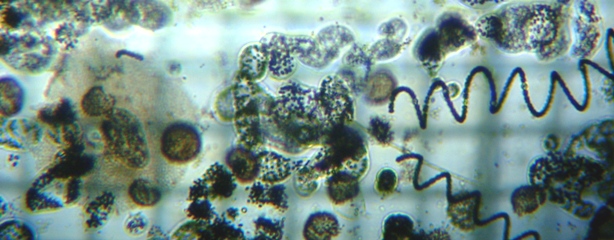 fig.06 �A�I�R���ۂ̐����i�Y�փP�r���J�Áj