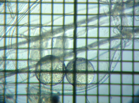 fig.02 ���X�̒�����i�ė��j
Leptodora kindtii (her egg)