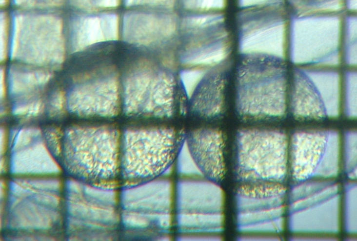 fig.03 ���X�̒�����i�ė��j
Leptodora kindtii (her egg)