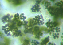 fig.04 �~�N���L�X�e�B�X