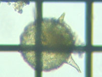 fig.05 �f�B�t���M�A��