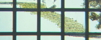 fig.05 �N�T���P�C�\�E