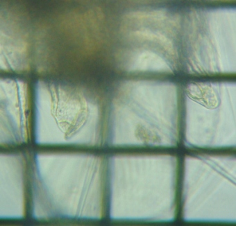 fig.03 �I�I�A�^�}�~�W���R��
�_��̂Q�i�P�΁j�̌�ڊ�