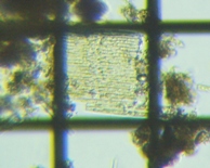 fig.04 �N�T���P�C�\�E