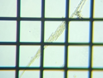 fig.05 �N�T���P�C�\�E