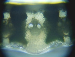 fig.07 ���V�̗t