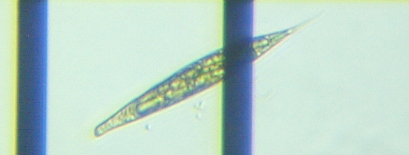 fig.04 ���[�O���i��