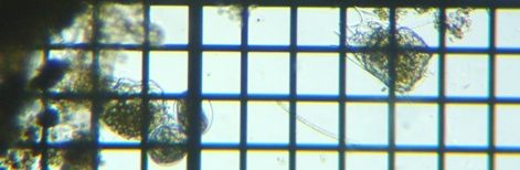 fig.04 �f�g���^�X�ƃc�{�����V